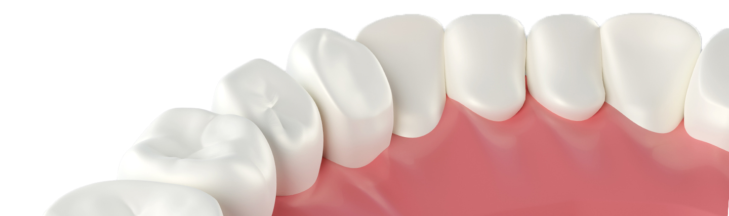 Dental Veneers: 3 Different Types and Their Costs